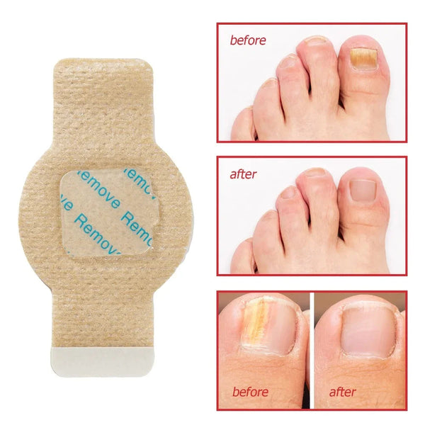 ActiveRestore Nail Patches